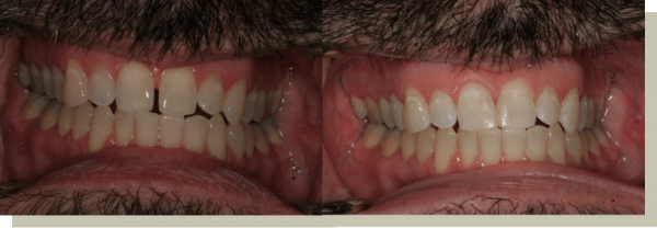 artisan dental